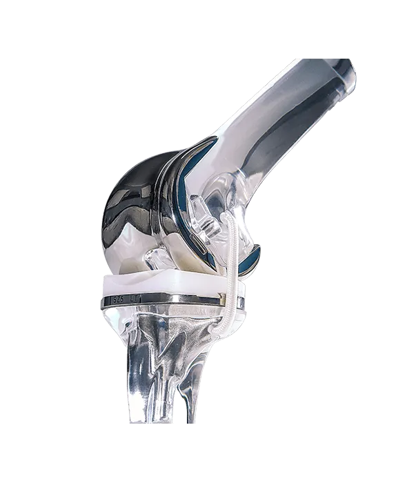 2.7.1_Orthopedics_Joint-Reconstruction